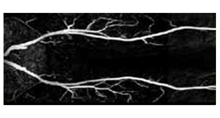 전신 혈관 자기 공명 영상(Whole Body Angiogram) 이미지