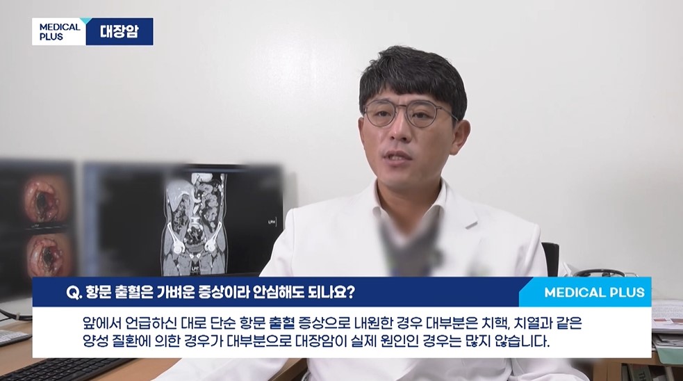 대장암에 대한 모든 것